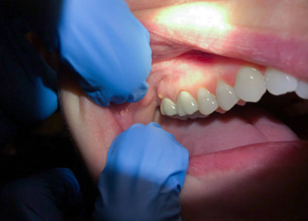 Best Pediatric Emergency Dentist in Prosser, WA