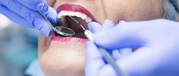 Best Emergency Root Canal Treatment in Prosser, WA